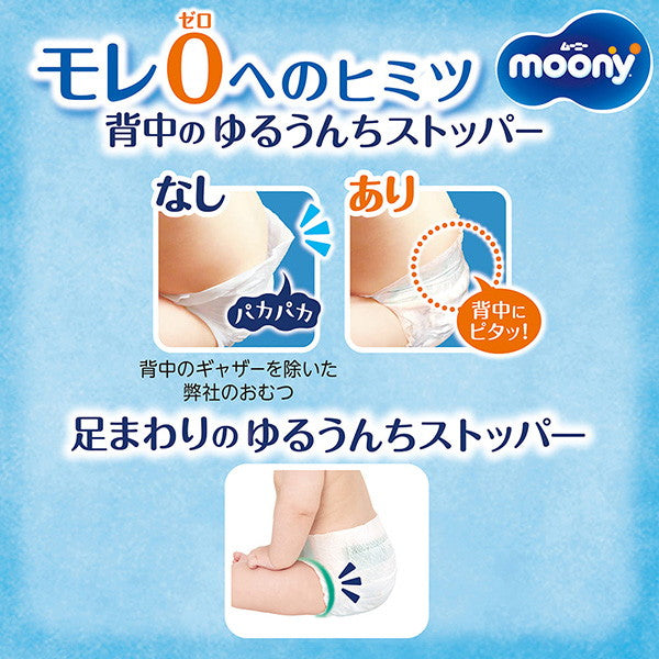 ムーニー M テープタイプ 56枚(4袋)